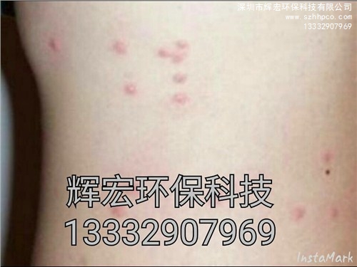 深圳殺臭蟲公司 |深圳殺臭蟲 |深圳宿舍殺臭蟲公司 |輝宏供-- 深圳市輝宏環(huán)保科技有限公司